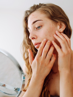 Cortisol & Skin: The Glow–Stress Connection (3 of 4)